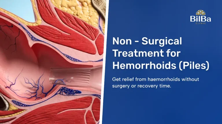 Non - Surgical Treatment for Hemorrhoids (Piles)