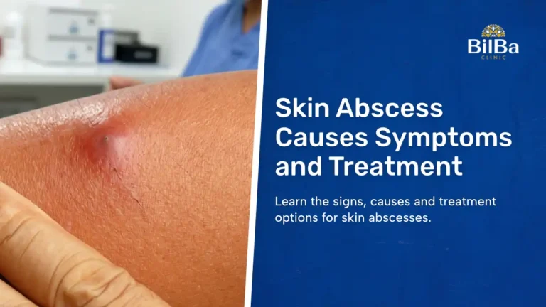 Skin Abscess blog thumbnail img