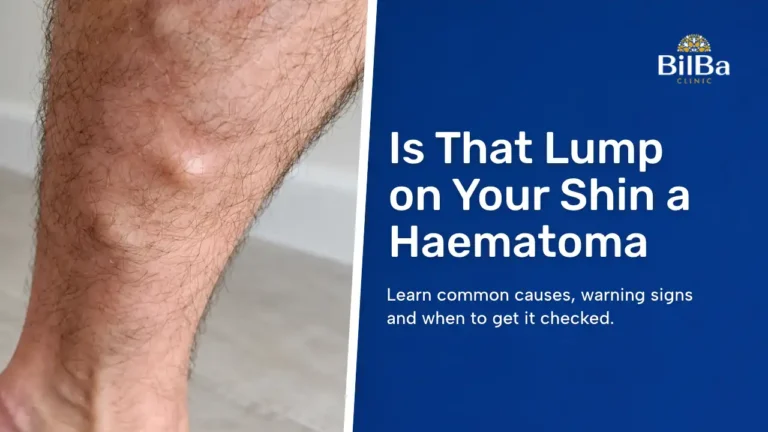 lump under skin on shin