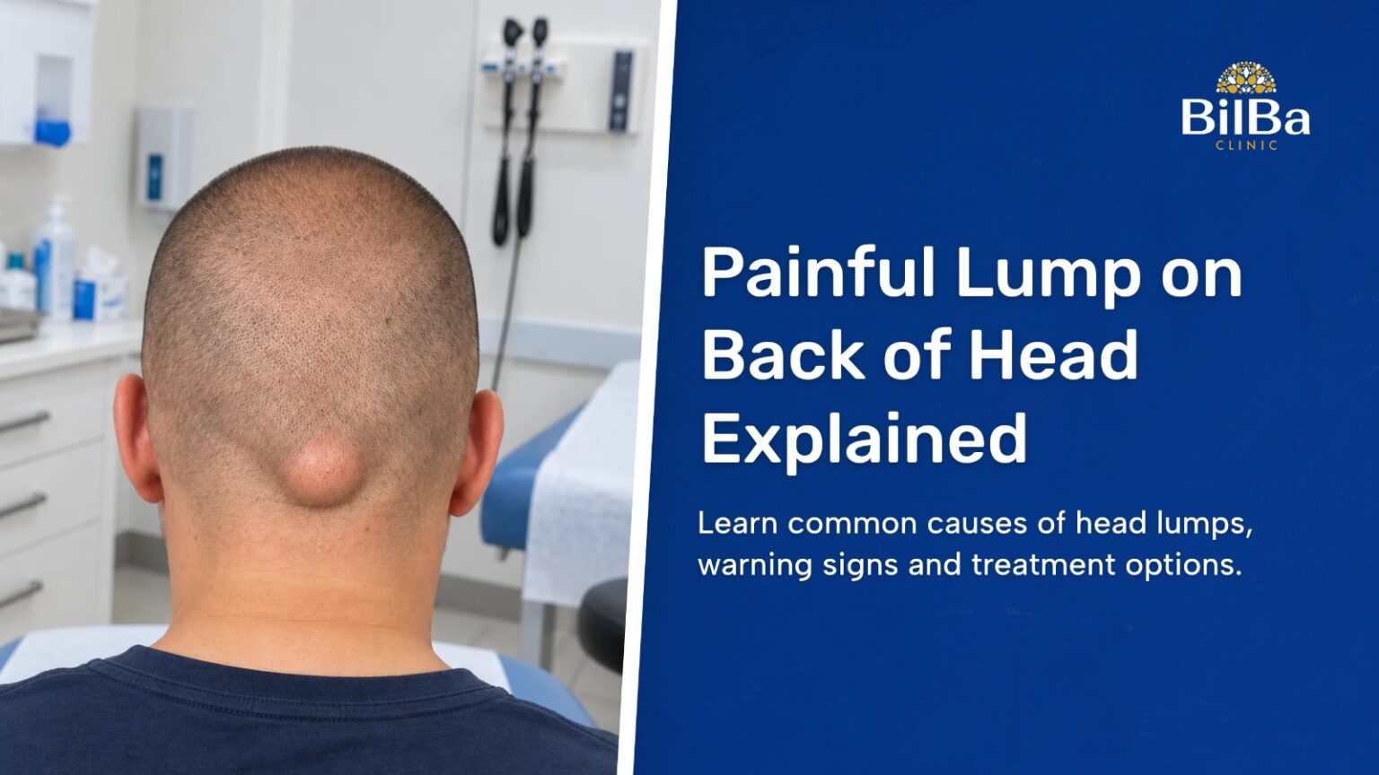 Lump on Back of Head Assessment and Removal in London