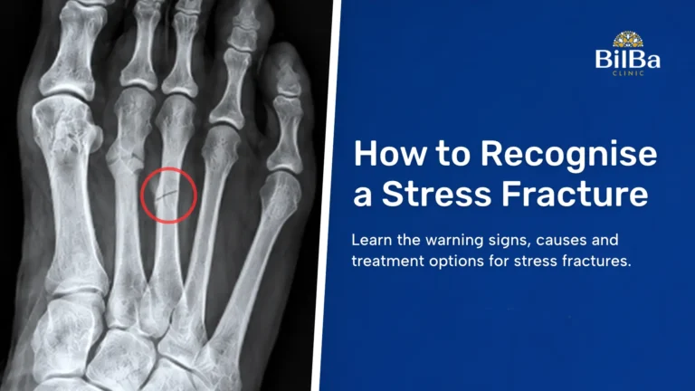 Stress Fracture bilba clinic