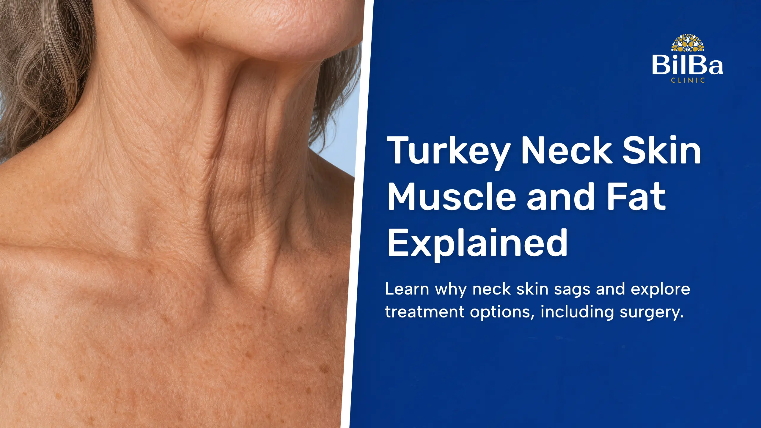 Is Turkey Neck a Skin, Muscle or Fat Problem